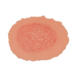 MedEduQuest Burn Wound Packing Trainer, Burn Moulage, Adhesive Skin Burn Wound Trainer for Wound Care Training, First Degree Burn Wound Training Model