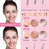 Fangze Blackhead Remover Tool Kit - 6pcs Pimple Popper Tool