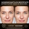 L'Oréal Paris Age Perfect: Serum Le Duo & Zell-Renaissance Tagespflege