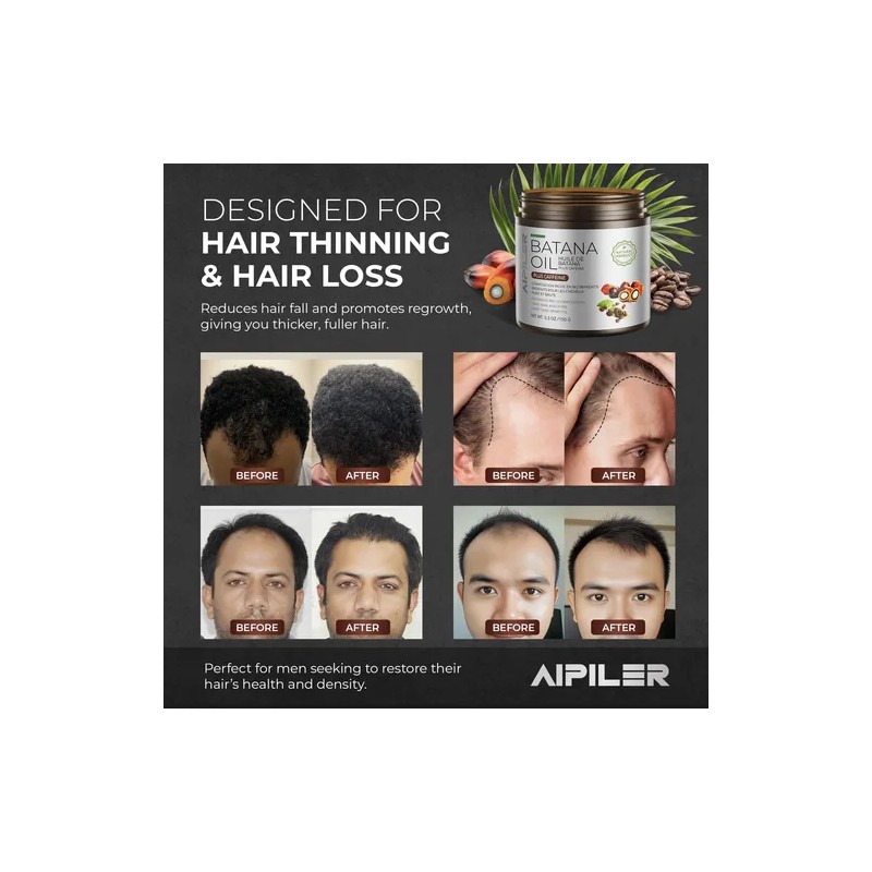 Aceite Para El Crecimiento Del Cabello Aipiler Batana Oil Co