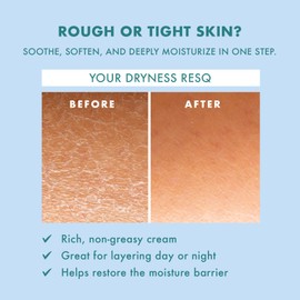 Petal Fresh Skin ResQ Hello Hydration Moisturizer, Hydrating Face Cream with 2% Hyaluronic Acid Complex and Jojoba Oil, Fragrance Free Facial Moisturizer for Dry Sensitive Skin, Made in Korea, 4 oz