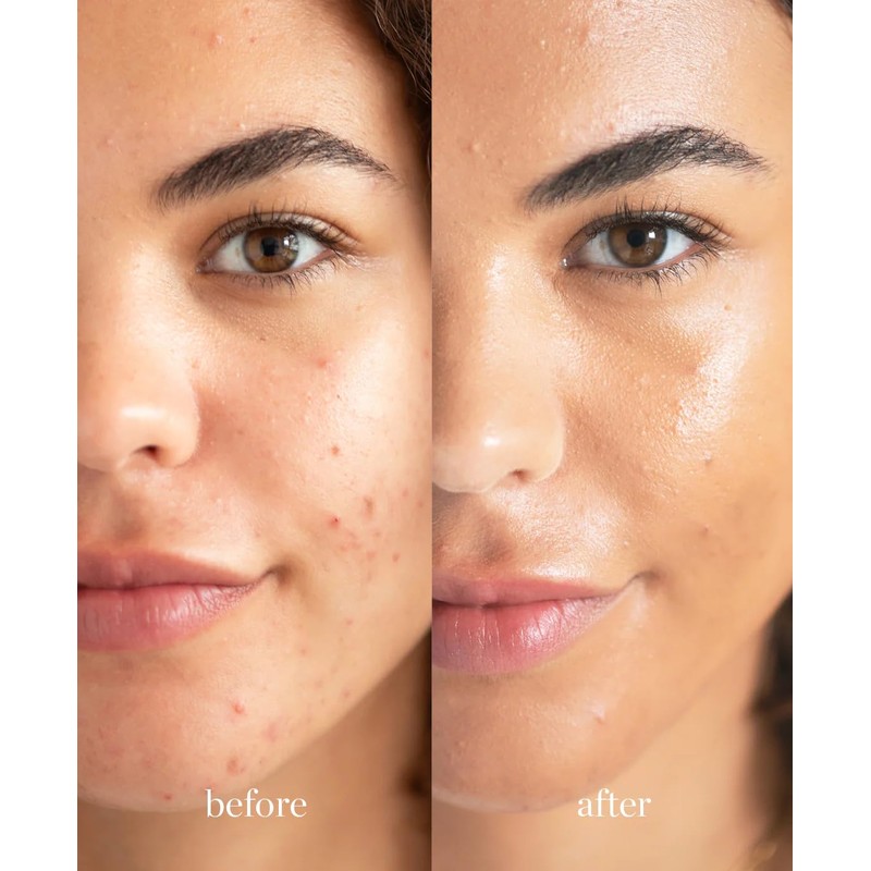 Ere Perez - Corrector natural de crema de lichi |