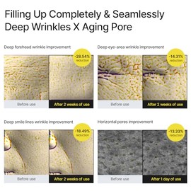 El potenciador reafirmante Vita A Retinal Shot  con retina liposomada, Matryxyl, minimizador de poros, arrugas y lneas finas, piel ms firme, 15 ml    