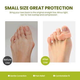 Bukihome Toe Separators Bunion Corrector - 8 Pack Big Toe Spacers with 2 Loops, Suitable for Bunion and Overlapping Toes, Reduce Foot Pain(Beige)