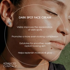Advanced Clinicals- Loción hidratante facial para eliminar manchas oscuras con cafeína, ácido láctico y vitamina A Crema iluminadora para el rostro