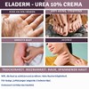 Eladerm Urea Cream 10% 100 ml Urea Cream, Keratosis, Psoriasis,