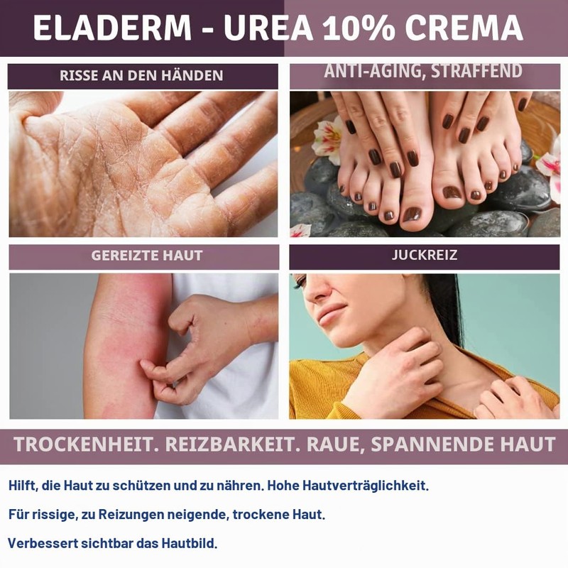 Eladerm Urea Cream 10% 100 ml Urea Cream, Keratosis, Psoriasis,