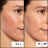 Retinol Serum Moisturizer Night Cream in Hyaluronic Acid-Face Eye Organic