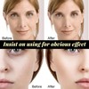 Protein Thread Lifting Set, Absorbable Collagen Thread, Active Collagen Silk