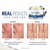 Vitamin K Cream- Moisturizing Bruise Healing Formula. Dark Spot Corrector