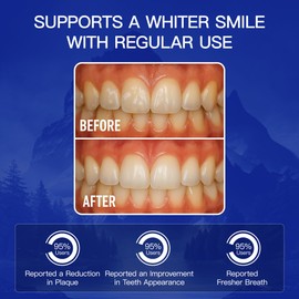 Remineralizing Gum Hydroxyapatite - Xylitol Gum Sugar Free for Oral Care - Natural Mastic Mint Peppermint Chewing Gum - Free Aspartame Plastic Dye Gluten - 72 Pieces