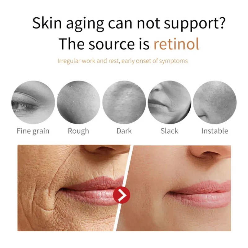 Sérum Facial De Vitamina C Eelhoe