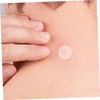WOONEKY Invisible Spot Patches 6 Sheets of Pimple Stickers Removal