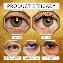 120PCS Avocado Eye Patches, Reduce Fine Lines and Wrinkles, Moisturizing Nourishing Eye Treatment Mask, Improving Eye Skin Dryness (Avocado Eye Cream)