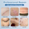 Advanced Silicone Scar Gel for Face & Body – Silicone