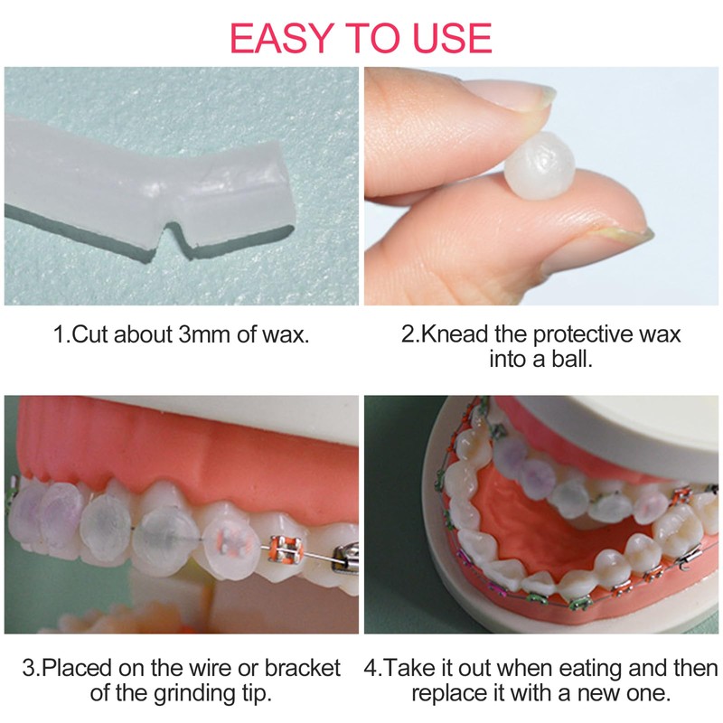 Newpop Pack of 10 Braces Wax, Orthodontic Wax, Tooth Wax