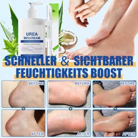 60% Urea Cream - Repair Cream for Feet and Hands - Foot Cream for Cracked Heels and Dry Skin - Maximum Strength for Hand, Foot and Body Care 200 ml