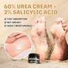 Clyecfra 60% Urea Cream with 2% Salicylic Acid, Urea Cream