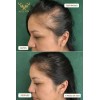 1 Shampoo Anticaída Y Crecimiento Chile Y Romero Vital Root