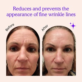BLUMBODY Face, Forehead Wrinkle Patches - Anti Wrinkle Facial Patches to Smooth Eye, Mouth, Forehead Wrinkles - Non-Silicone Face Tape for Fine Wrinkles between Eyes, Face - Patches (30 day supply)