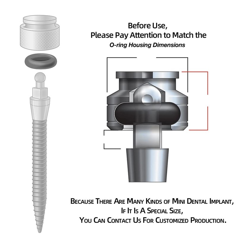 MDLMOR10Z MDLORZ Replacement O Ring Kit, for Intralock Mini Implant