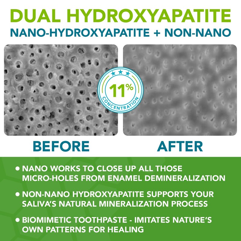 Nano hydroxyapatite Toothpaste Fluoride Free; Dentist Formulated Pro Remineralizing Toothpaste