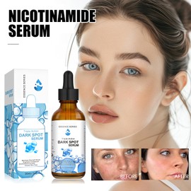 Advanced Skin Brightening Serum with Niacinamide & Hyaluronic Acid - Targets Hyperpigmentation, Enhances Radiance & Hydration for All Skin Types