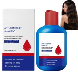 300ml Scalp Care Shampoo,Selen/ium Sulfi/de Shampoo,Oil Control Refreshing Anti-Dandruff Cleansing Shamp/oo,Anti-Dandruff Shampo/os,Hair Care Shampo/os,Dandruff Scalp Treatment