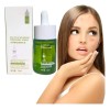 Suero Tratamiento Facial Contra Acné Ácido Salicílico 30ml F Todo