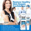 Keloid Bump Removal, Keloid Scar Treatment for Face, Body, Advanced