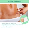 4 Pcs Elaimei Silicone Scar Sheets Stretch Marks Remover Post
