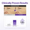 Centellian24 360 Shot PDRN Active Serum, 50 ml