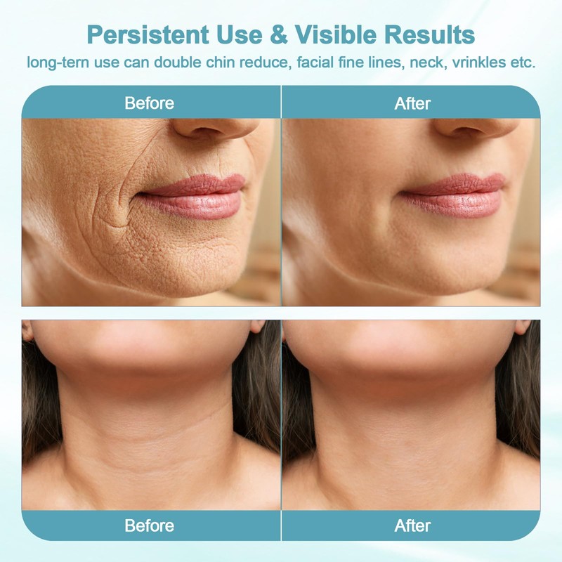 Face Massager Against Wrinkles, 7-in-1 Face Beauty Device with 3