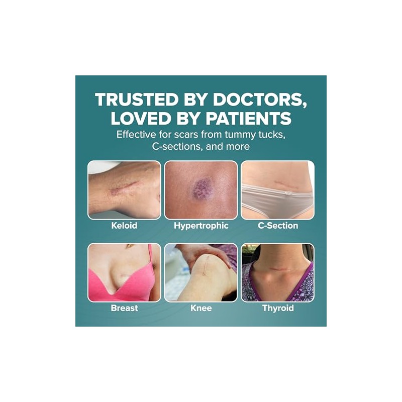 Biodermis . Lámina de silicon ideal para tratar y reducir
