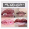 Aichun Beauty Moisturizing Strawberry Lip Balm For Very Dry Chapped