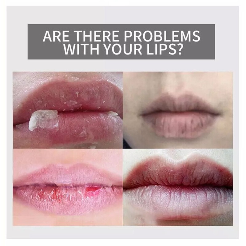 Aichun Beauty Moisturizing Strawberry Lip Balm For Very Dry Chapped