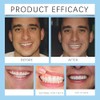Oralhoe Kit de Rebase de Silicona para Prótesis Dentales, Suave