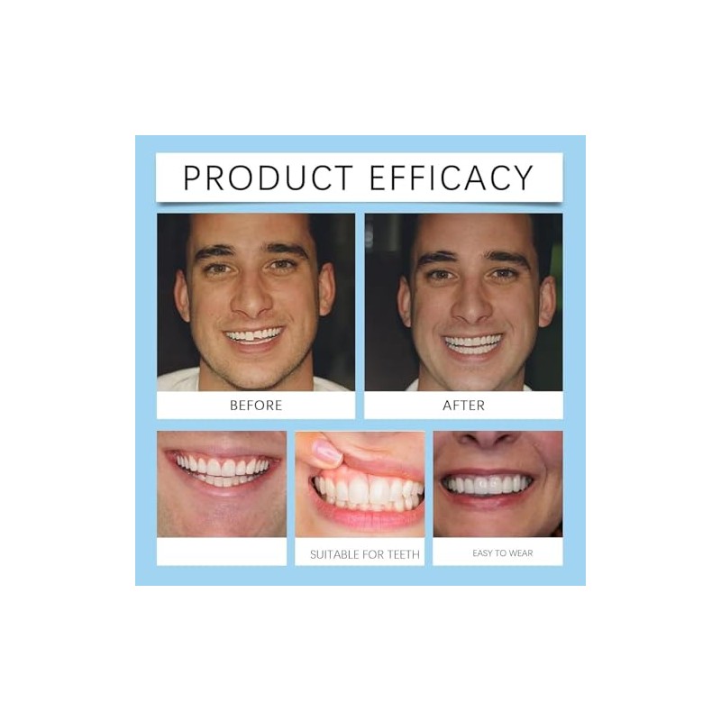 Oralhoe Kit de Rebase de Silicona para Prótesis Dentales, Suave