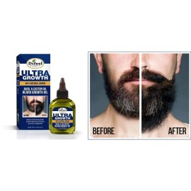 Aceite Para Hacer Crecer La Barba Y Bigote Rapido Natural Crecimiento De Barba