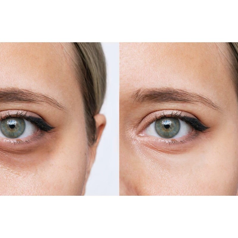 AcquaGraph - Eye Contour Youth Booster | Anti-Ageing Moisturising Cream