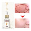 Serum Suave Blanquea Piel Aclara Suaviza Poros Moda Coreana Normal