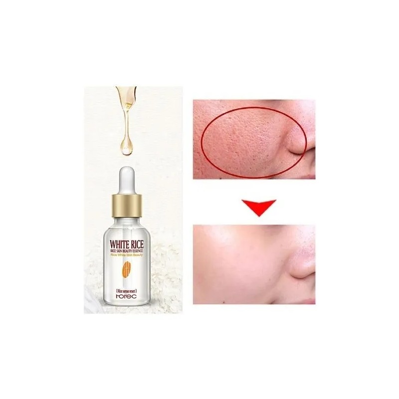 Serum Suave Blanquea Piel Aclara Suaviza Poros Moda Coreana Normal