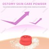 Polvo Protector Para Piel Con Faja Colostomía Antifugas Suav