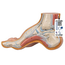 3B Scientific M32 Hollow Foot, Pes Cavus + free Anatomy App - 3B Smart Anatomy