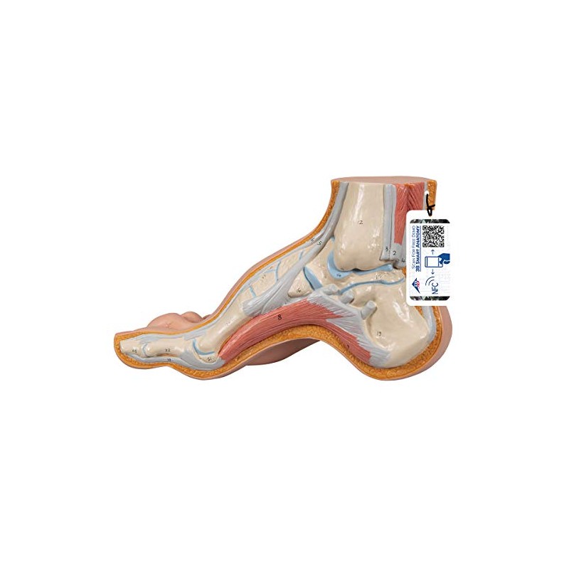 3B Scientific M32 Hollow Foot, Pes Cavus + free Anatomy