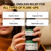 Thyme & Tea Tree Flare Care | Solution for Painful