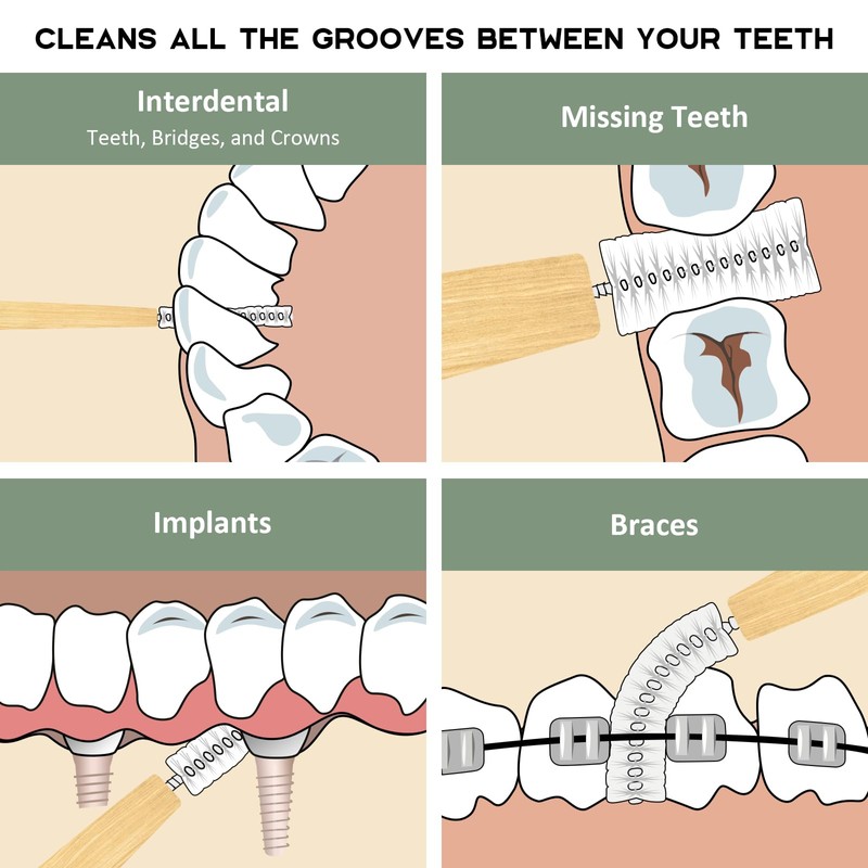 Isshah Bamboo Interdental Brushes, Between Teeth Cleaner Deep Clean Brush,