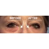 Instantly Ageless 5 Ampolletas. Antiarrugas Instantaneo y Antiojeras
