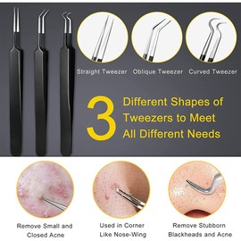10pcs Pimple Popper Tool Kit Stainless Steel Blackhead Remover Tool Comedones Extractor for Forehead Facial Nose Lightweight Acne Needle Tool with Metal Case(black)