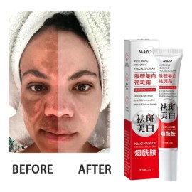 Crema Facial Despigmentante Y Aclarante 20g Todo Tipo De Piel Día/noche
